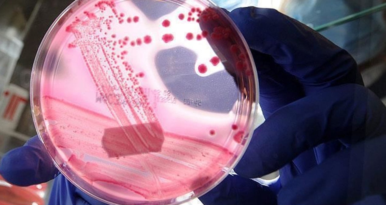 erkeklerde en cok gorulen ikinci kanser turu belli oldu JmgmbOn5